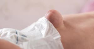 Congenital Diaphragmatic Hernia: Early Detection and Management in Newborns